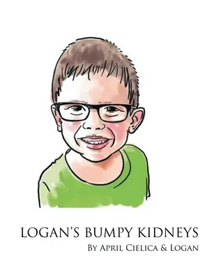 Logan dudoros veséi - Logan's Bumpy Kidneys