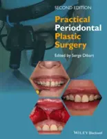 Gyakorlati periodontális plasztikai sebészet - Practical Periodontal Plastic Surgery