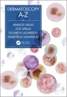 Dermatoszkópia A-Z - Dermatoscopy A-Z