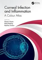 Szaruhártya fertőzés és gyulladás: Színes atlasz - Corneal Infection and Inflammation: A Colour Atlas