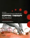 Hagyományos kínai orvoslás csészeterápia - Traditional Chinese Medicine Cupping Therapy