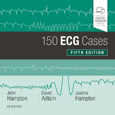 150 EKG eset - 150 ECG Cases