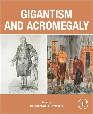 Gigantizmus és akromegália - Gigantism and Acromegaly
