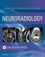 Neuroradiológiai képalkotó esetek áttekintése - Neuroradiology Imaging Case Review