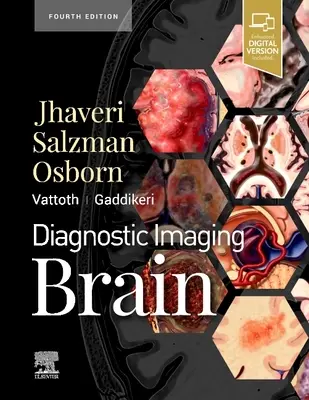 Diagnosztikai képalkotás: Brain - Diagnostic Imaging: Brain