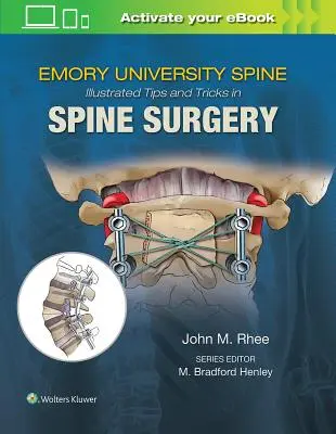 Emory illusztrált tippjei és trükkjei a gerincsebészetben - Emory's Illustrated Tips and Tricks in Spine Surgery