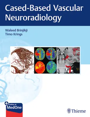 Képalkotás a neurovaszkuláris betegségekben: A Case-Based Approach - Imaging in Neurovascular Disease: A Case-Based Approach