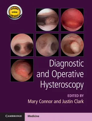 Diagnosztikus és operatív hiszteroszkópia - Diagnostic and Operative Hysteroscopy