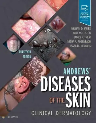 Andrews: A bőr betegségei: Bőrgyógyászat: Klinikai bőrgyógyászat - Andrews' Diseases of the Skin: Clinical Dermatology