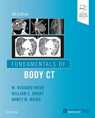 A test CT alapjai - Fundamentals of Body CT