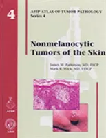 A bőr nem melanocitikus daganatai - Nonmelanocytic Tumors of the Skin