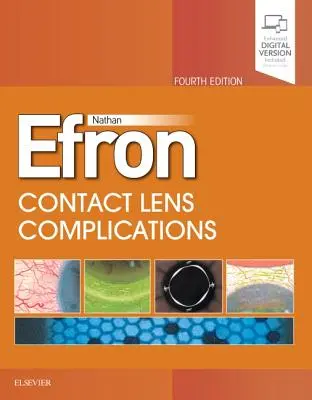 Kontaktlencse-szövődmények - Contact Lens Complications