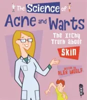 A pattanások és szemölcsök tudománya - A viszkető igazság a bőrről - Science Of Acne & Warts - The Itchy Truth About Skin