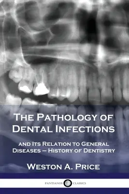 A fogászati fertőzések patológiája: és kapcsolata az általános betegségekkel - A fogászat története - The Pathology of Dental Infections: and Its Relation to General Diseases - History of Dentistry