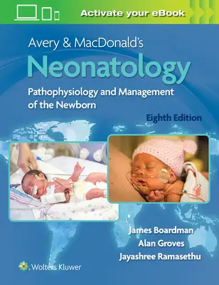 Avery & Macdonald's Neonatology: Pathophysiology and Management of the Newborn (Az újszülött patofiziológiája és kezelése) - Avery & Macdonald's Neonatology: Pathophysiology and Management of the Newborn