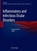 Gyulladásos és fertőző szemészeti betegségek - Inflammatory and Infectious Ocular Disorders