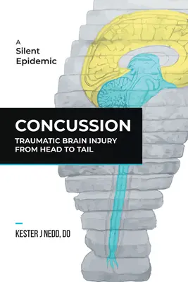 Megrázkódtatás: Traumatikus agysérülés a fejtől a farokig - Concussion: Traumatic Brain Injury from Head to Tail