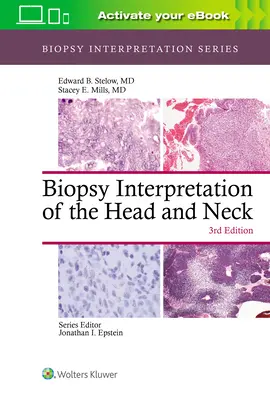 A fej és a nyak biopsziaértelmezése - Biopsy Interpretation of the Head and Neck