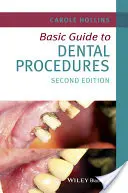 Alapvető útmutató a fogászati eljárásokhoz - Basic Guide to Dental Procedures