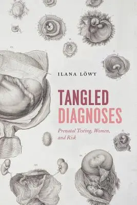 Összegabalyodott diagnózisok: Születés előtti tesztelés, nők és kockázat - Tangled Diagnoses: Prenatal Testing, Women, and Risk