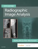 Radiográfiai képelemzés - Radiographic Image Analysis