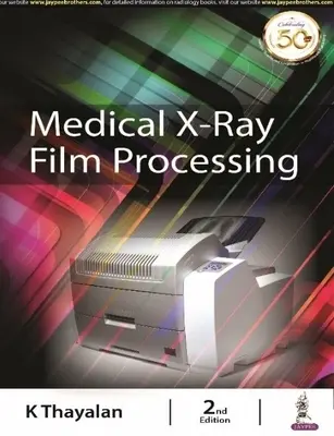 Orvosi röntgenfilm-feldolgozás - Medical X-ray Film Processing