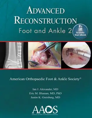 Haladó rekonstrukció: Láb és boka 2: Nyomtatás + eKönyv - Advanced Reconstruction: Foot and Ankle 2: Print + eBook