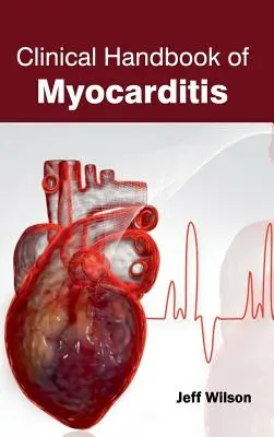 A szívizomgyulladás klinikai kézikönyve - Clinical Handbook of Myocarditis