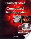 A komputertomográfia gyakorlati atlasza - Practical Atlas of Computed Tomography