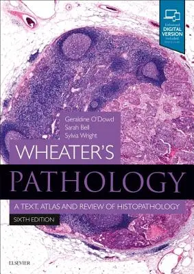 Wheater patológiája: A Text, Atlas and Review of Histopathology - Wheater's Pathology: A Text, Atlas and Review of Histopathology