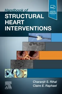 A strukturális szívbeavatkozások kézikönyve - Handbook of Structural Heart Interventions