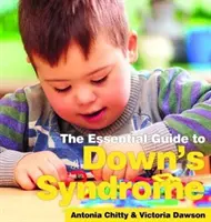 Down-szindróma: Az alapvető útmutató - Down's Syndrome: The essential Guide