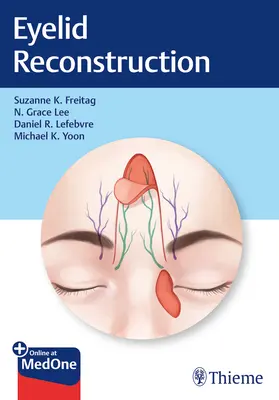 Szemhéjrekonstrukció - Eyelid Reconstruction