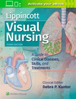 Lippincott Visual Nursing: A Guide to Clinical Diseases, Skills, and Treatments (Útmutató a klinikai betegségekhez, készségekhez és kezelésekhez) - Lippincott Visual Nursing: A Guide to Clinical Diseases, Skills, and Treatments