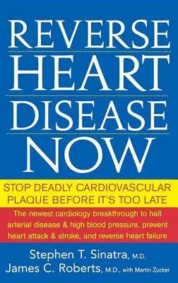 Reverse Heart Disease Now: Állítsa meg a halálos szív- és érrendszeri plakkokat, mielőtt túl késő lenne - Reverse Heart Disease Now: Stop Deadly Cardiovascular Plaque Before It's Too Late