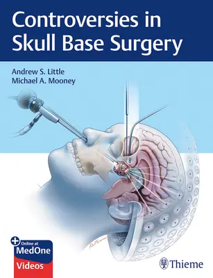 A koponyaalapi sebészet ellentmondásai - Controversies in Skull Base Surgery