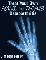 Kezelje a saját kezét és hüvelykujját Osteoarthritis - Treat Your Own Hand and Thumb Osteoarthritis