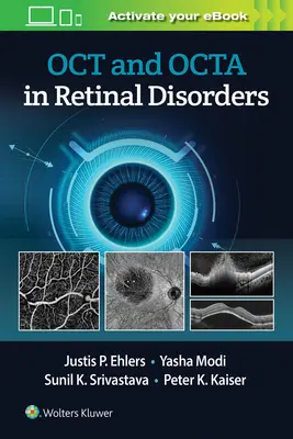 Oct és Octa a retina rendellenességeiben - Oct and Octa in Retinal Disorders