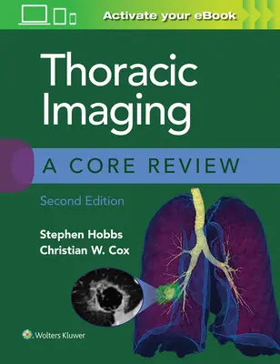 Mellkasi képalkotás: A Core Review - Thoracic Imaging: A Core Review