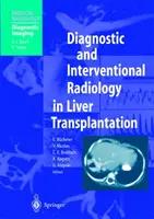 Diagnosztikai és intervenciós radiológia a májtranszplantációban - Diagnostic and Interventional Radiology in Liver Transplantation