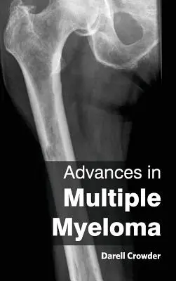 Fejlemények a myeloma multiplexben - Advances in Multiple Myeloma