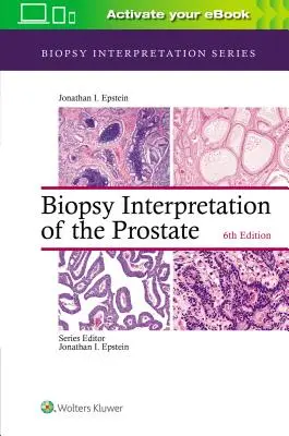 A prosztata biopsziájának értelmezése - Biopsy Interpretation of the Prostate