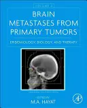 A primer tumorok agyi áttétei, 2. kötet: Epidemiológia, biológia és terápia - Brain Metastases from Primary Tumors, Volume 2: Epidemiology, Biology, and Therapy