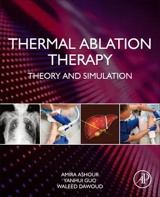 Termikus ablációs terápia: Elmélet és szimuláció - Thermal Ablation Therapy: Theory and Simulation