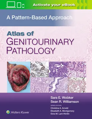 Az urogenitális patológia atlasza: A Pattern Based Approach - Atlas of Genitourinary Pathology: A Pattern Based Approach