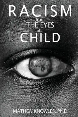 Rasismus očima dítěte - Racism From the Eyes of a Child