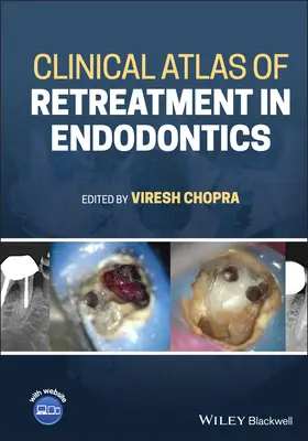 Az endodontiai retardáció klinikai atlasza - Clinical Atlas of Retreatment in Endodontics