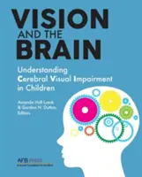 A látás és az agy: A gyermekkori agyi látáskárosodás megértése - Vision and the Brain: Understanding Cerebral Visual Impairment in Children