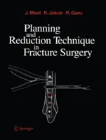 Tervezés és redukciós technika a töréssebészetben - Planning and Reduction Technique in Fracture Surgery