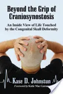 A kranioszinosztózis szorításán túl: A veleszületett koponyadeformitás által érintett élet belső látlelete - Beyond the Grip of Craniosynostosis: An Inside View of Life Touched by the Congenital Skull Deformity